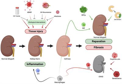 Chronic Kidney Allograft Disease: New Concepts and Opportunities